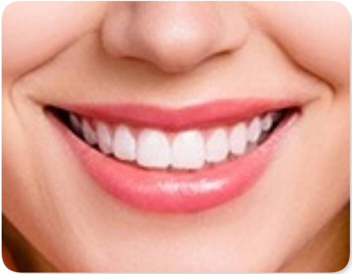 How can I get rid of yellow teeth at home