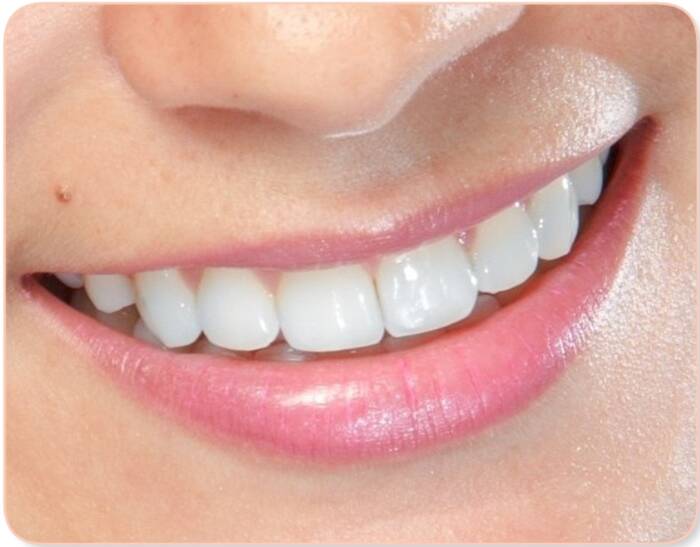 What can I do for a missing front tooth