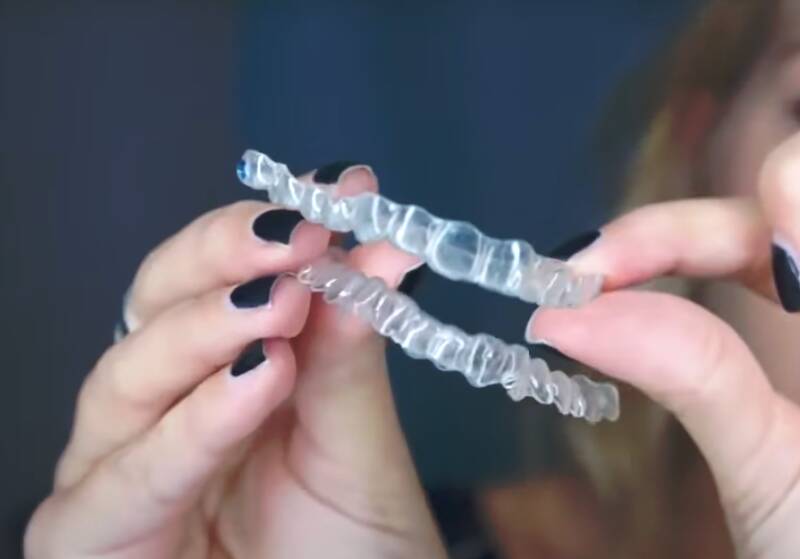 How to Clean Stained Invisalign Aligners