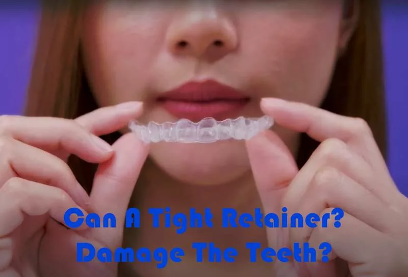 Can A Tight Retainer Damage The Teeth